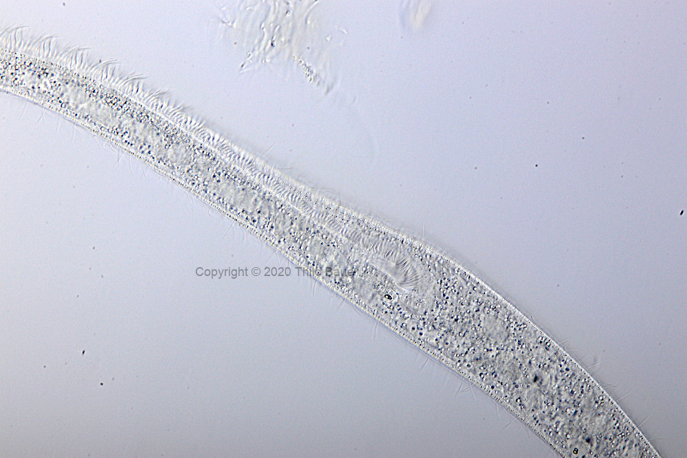 Spirostomum minus